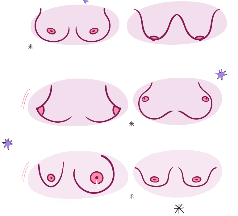 breast